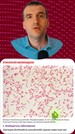 03 Какой микроб вызывает мелиоидоз. Свойства бактерии, вызывающей мелиоидоз. (Мелиоидоз - 03 Этиология)
