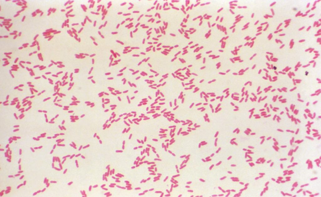 Бактерии Pseudomonas pseudomallei. Микрофотография. Dr. W. A. Clark / Centers for Disease Control and Prevention (CDC) https://bigenc.ru/c/melioidoz-cheloveka-94e7fb