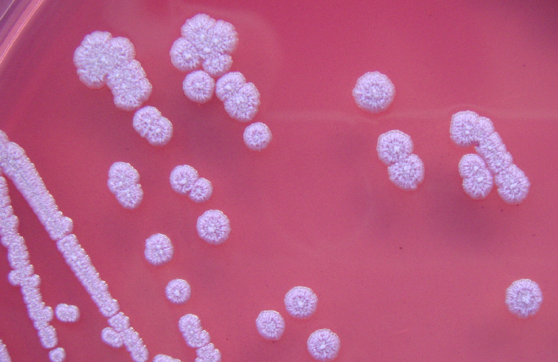 Увеличение в 5 раз колоний Burkholderia pseudomallei на агаре Эшдауна после 4 дней инкубации. Изображение предоставлено: Гэвин Ко, CC BY-SA 4.0, через Wikimedia Commons