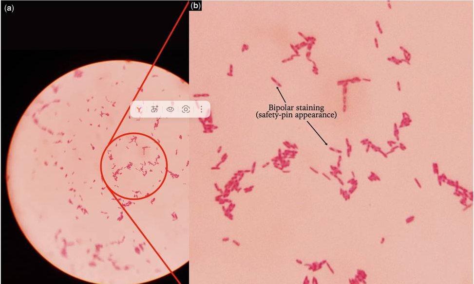 https://www.ncbi.nlm.nih.gov/core/lw/2.0/html/tileshop_pmc/tileshop_pmc_inline.html?title=Click%20on%20image%20to%20zoom&p=PMC3&id=11604210_hcae125f1.jpg