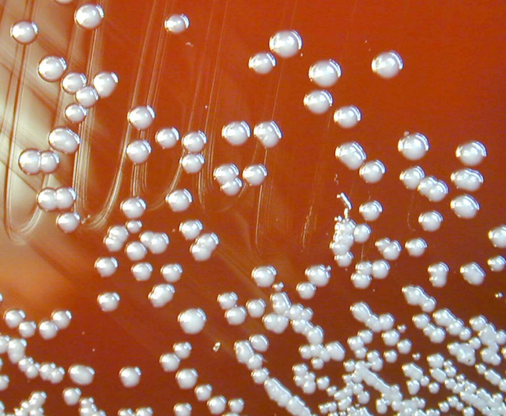 Колонии Burkholderia pseudomallei на кровяном агаре. Источник: https://руни.рф/Burkholderia_pseudomallei